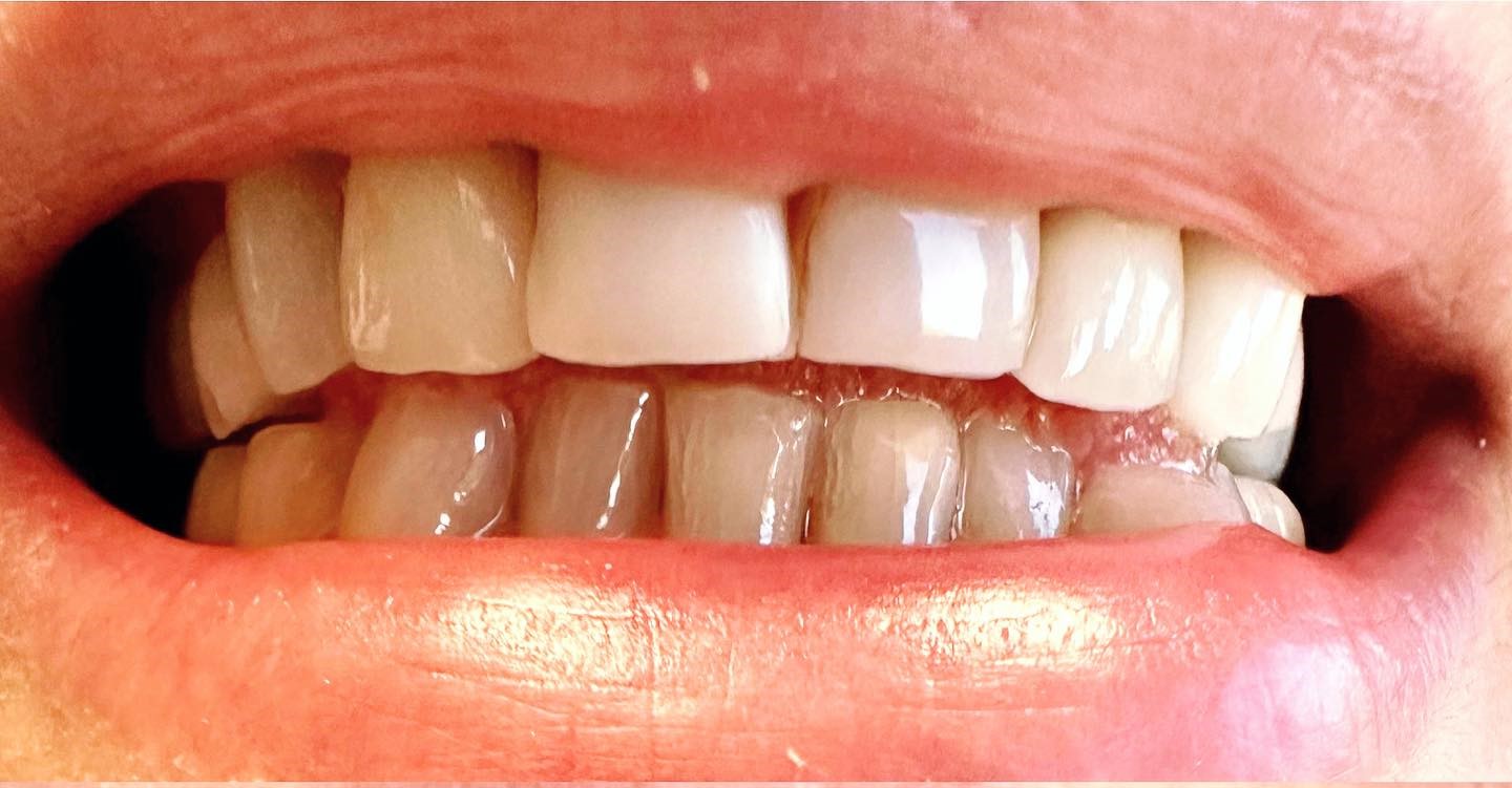 Hilltop Dental by Dr. George Apelian Hilltop Dental by Dr. George Apelian