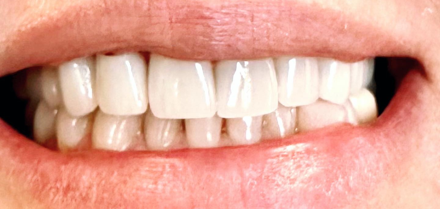 Hilltop Dental by Dr. George Apelian