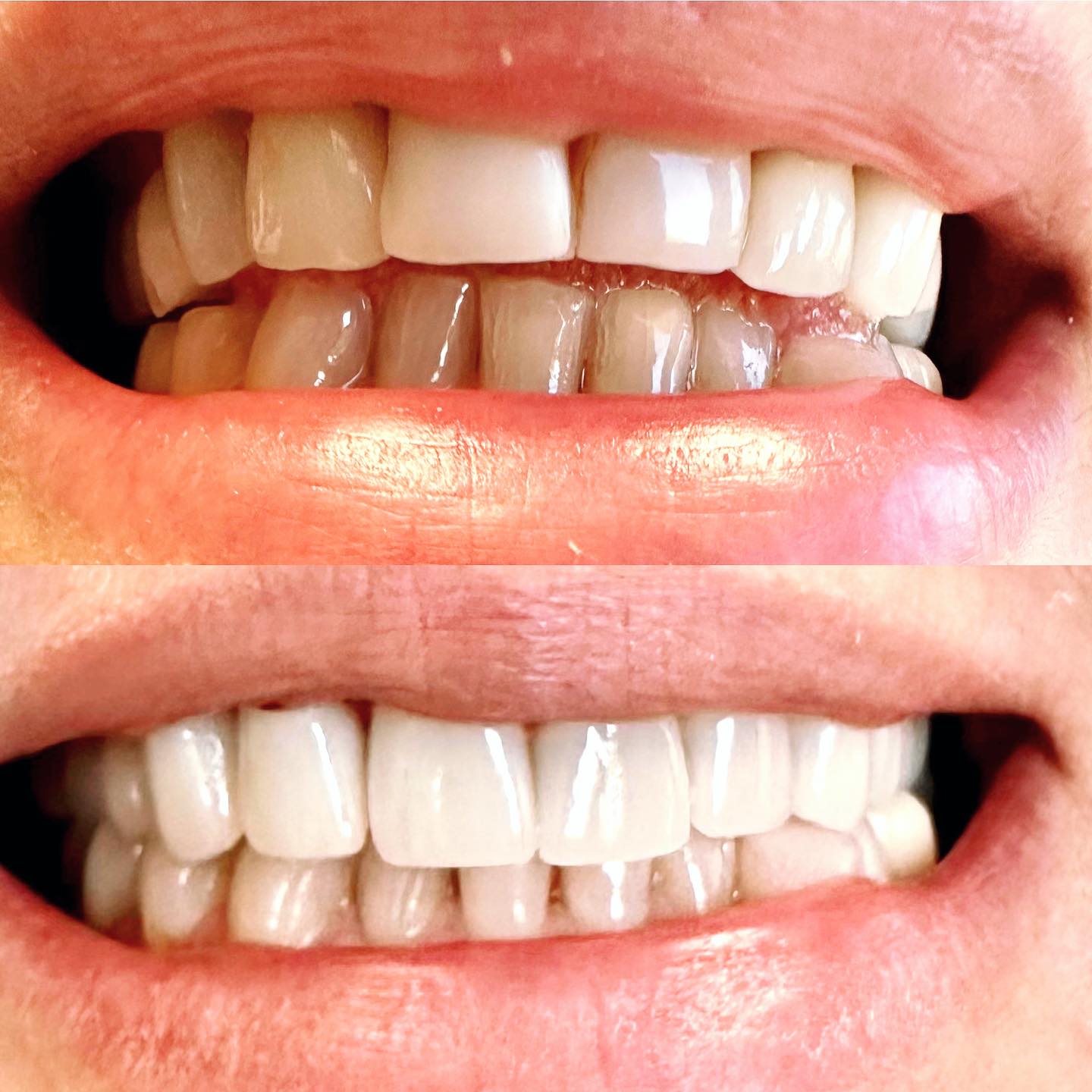 before-after before-after