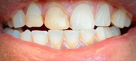 Hilltop Dental by Dr. George Apelian Hilltop Dental by Dr. George Apelian