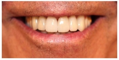 Hilltop Dental by Dr. George Apelian