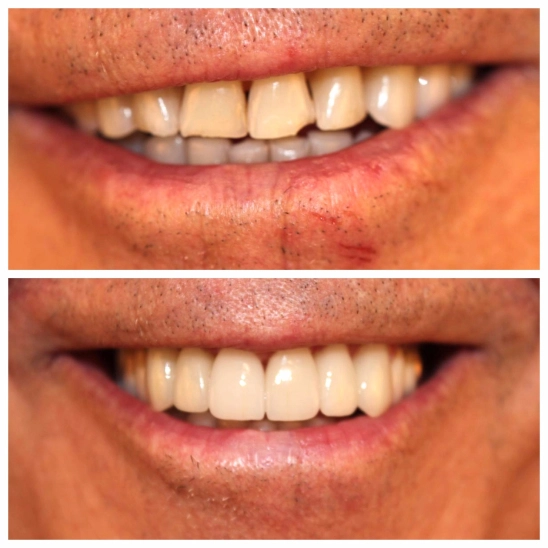 before-after before-after