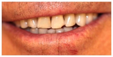 Hilltop Dental by Dr. George Apelian Hilltop Dental by Dr. George Apelian